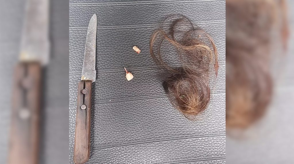 Mulher teve dentes quebrados com pedra e foi violentada durante cárcere privado no Paraná