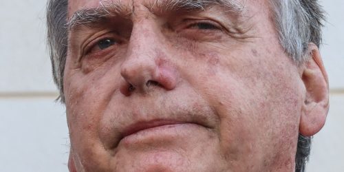 Bolsonaro apresenta piora clínica e vai passar por novos exames Imagem referente a Bolsonaro apresenta piora clínica e vai passar por novos exames