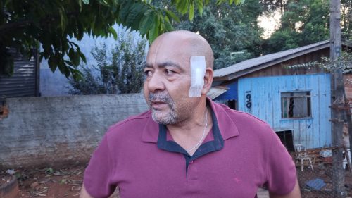 Morador fala sobre susto após caminhão descer a via desgovernado e atingir residência Morador fala sobre susto após caminhão descer a via desgovernado e atingir residência