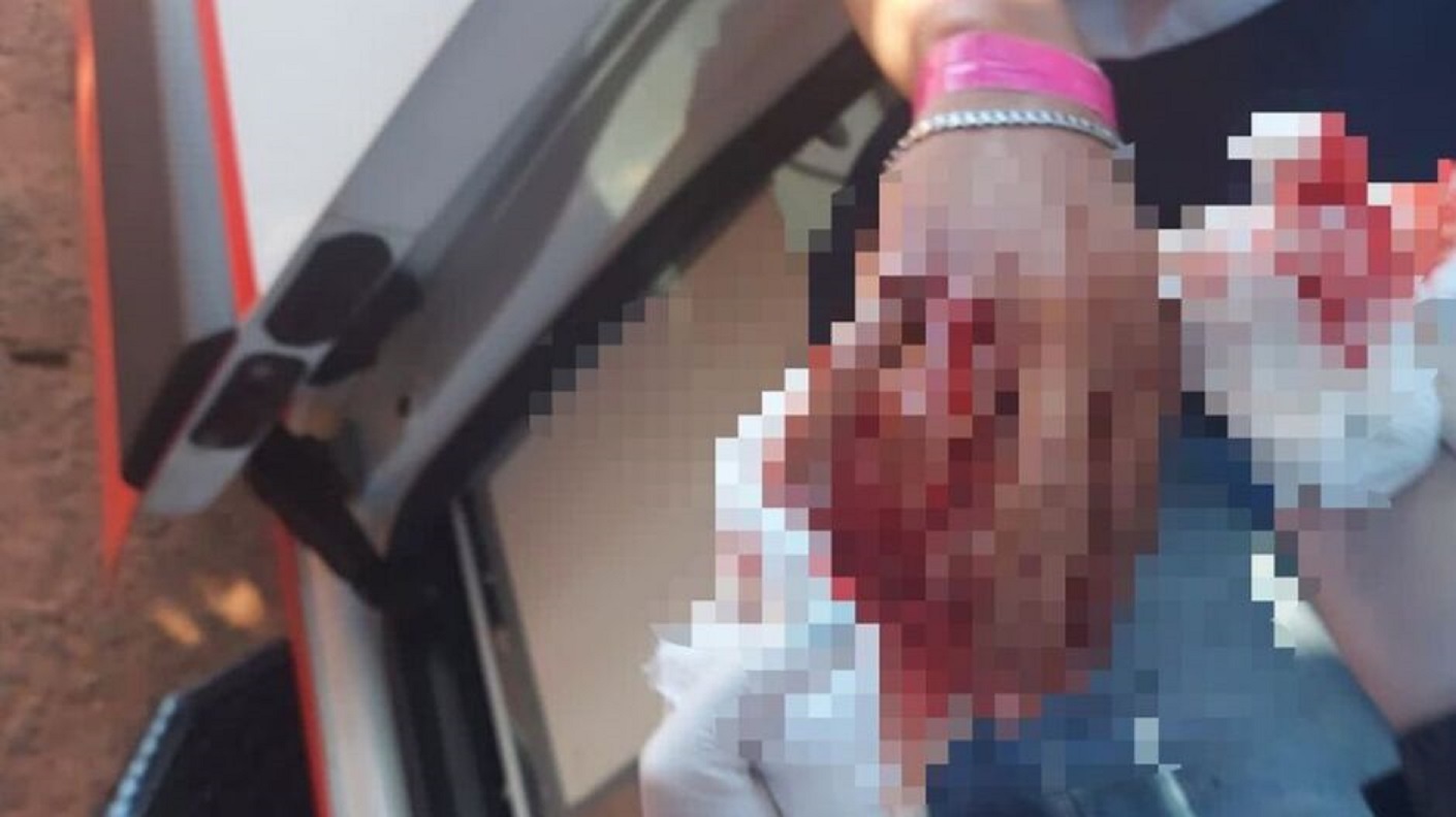 Agressão brutal: jovem de 18 anos é esfaqueado em plena luz do dia