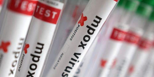 Região Norte do Brasil registra casos de mpox Imagem referente a Região Norte do Brasil registra casos de mpox