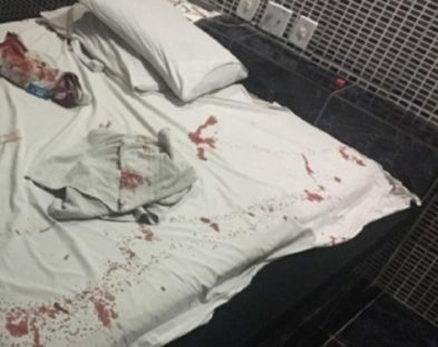 Noite de prazer vira pesadelo: Sargento da PM e travesti se envolvem em briga sangrenta Imagem referente a Noite de prazer vira pesadelo: Sargento da PM e travesti se envolvem em briga sangrenta