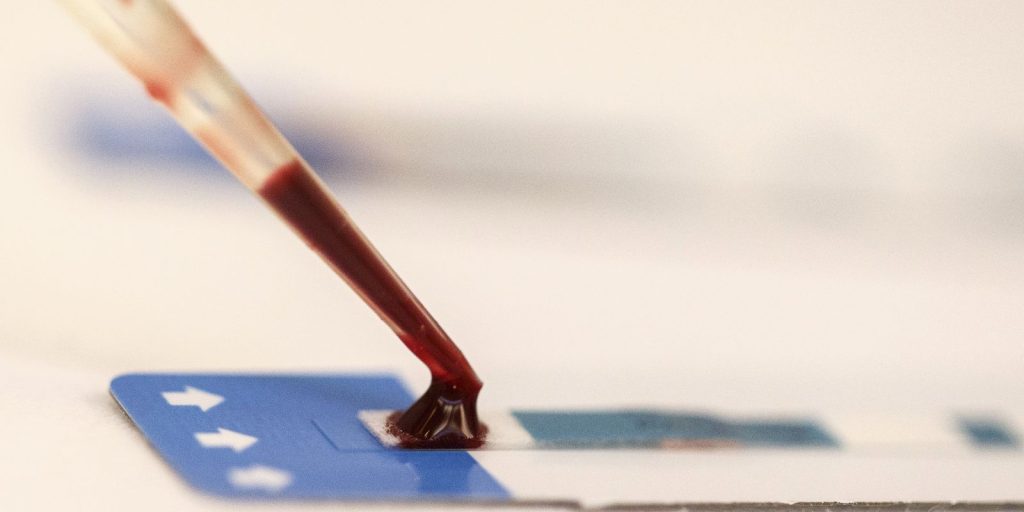 Cascavel abre licitação de mais de R$ 2 milhões para compra de exames de HIV
