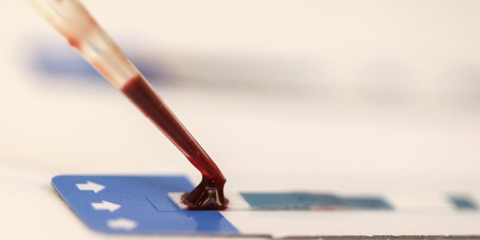 Cascavel abre licitação de mais de R$ 2 milhões para compra de exames de HIV