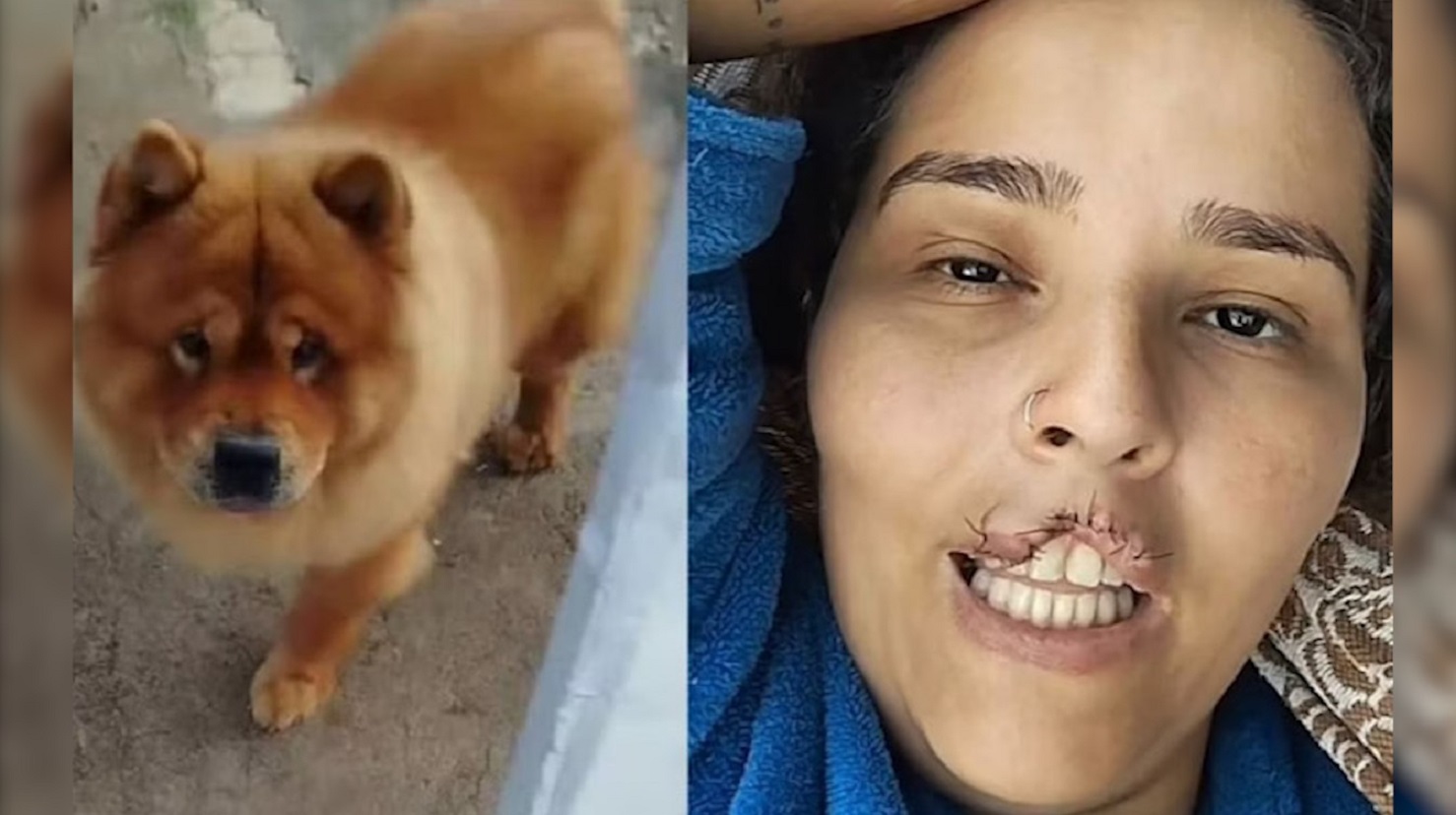 Cachorro chow-chow arranca lábio de tutora e é submetido a eutanásia