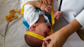 INSS pagará indenização de R$ 60 mil a crianças vítimas de zika
