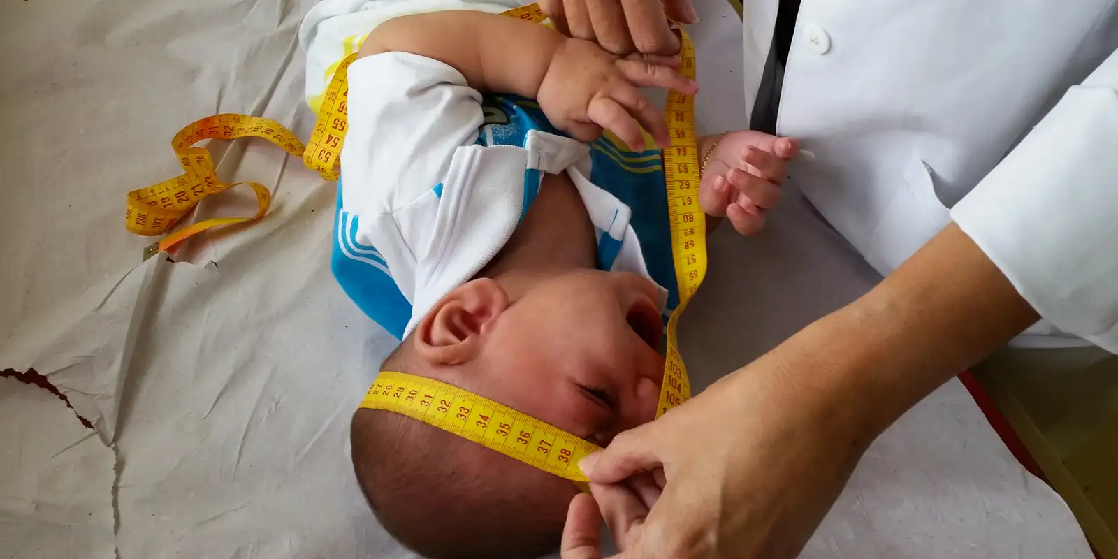 INSS pagará indenização de R$ 60 mil a crianças vítimas de zika