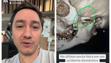 Imagem referente a Acidente doméstico leva vereador a procedimento cirúrgico: “Rezem por mim”