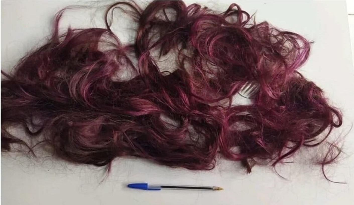 Ex-marido foragido da justiça ataca e corta cabelo de ex-mulher após esfaqueá-la