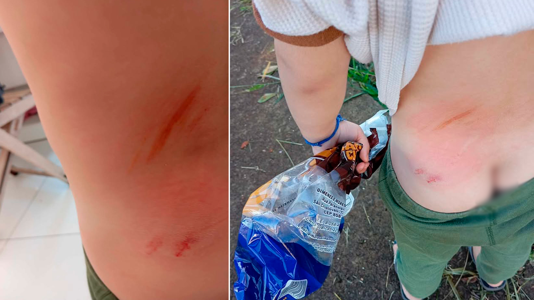 Menino de 3 anos é atacado por cachorro de rua no bairro Esmeralda, em Cascavel