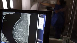 Câncer de mama: uma em cada três pacientes tem menos de 50 anos