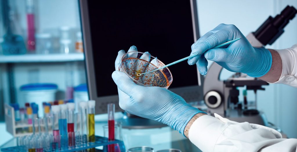 Cascavel investe mais de R$ 140 mil na aquisição de insumos para exames de microbiologia