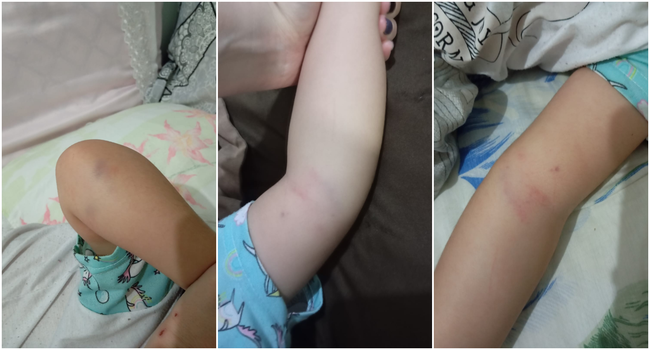 Mãe denuncia agressão a criança de três anos em colégio particular de Cascavel