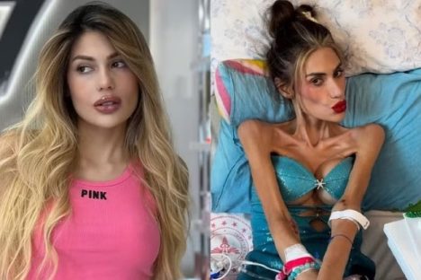 Morre influencer de 30 anos que pesava 22 kg: “Arruinaram a vida dela” Imagem referente a Morre influencer de 30 anos que pesava 22 kg: “Arruinaram a vida dela”