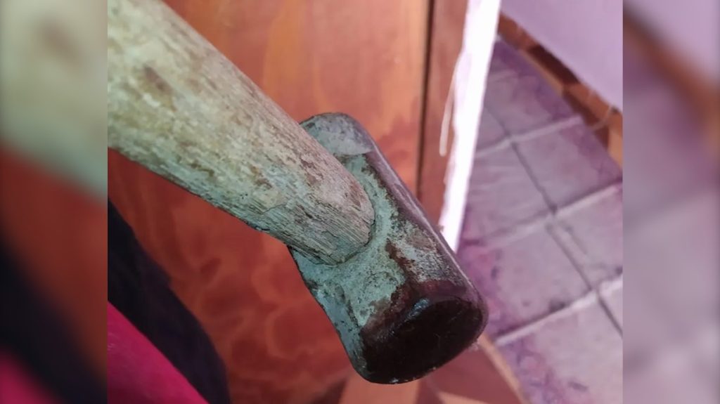 ‘Maridão’ deixa esposa hospitalizada com golpe de marreta e foge da PM em Laranjeiras do Sul