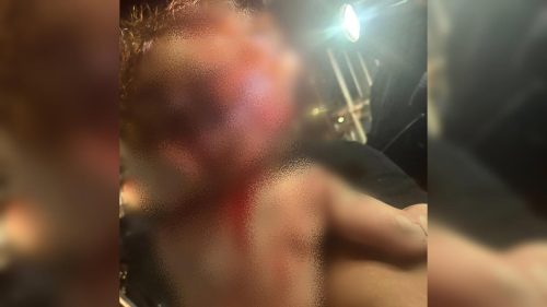 Ex invade casa e tenta matar mãe e bebê de 10 meses Imagem referente a Ex invade casa e tenta matar mãe e bebê de 10 meses