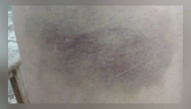 Imagem referente a Marido cansado de apanhar denuncia esposa grávida por agressão
