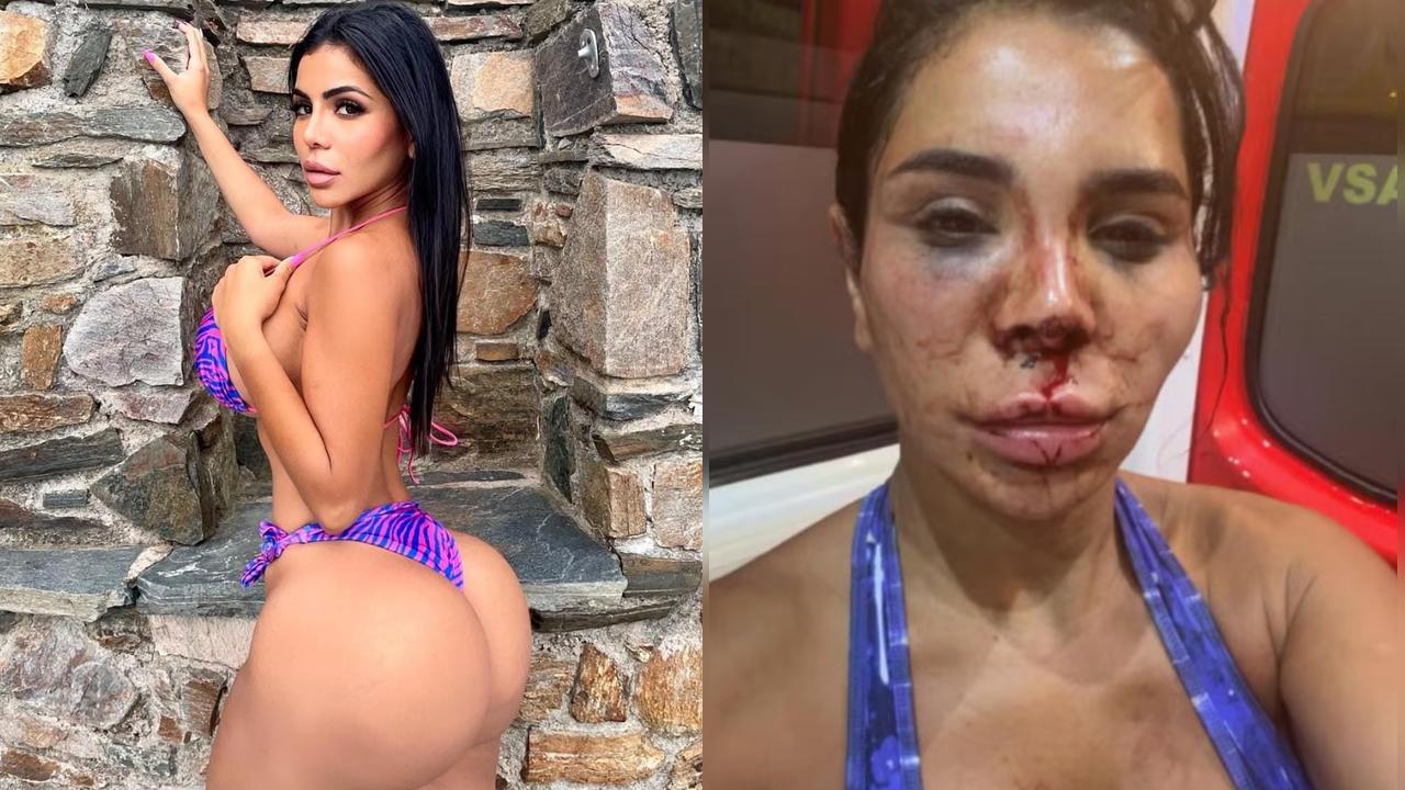 Influenciadora é brutalmente agredida e possivelmente estuprada durante assalto em casa na França