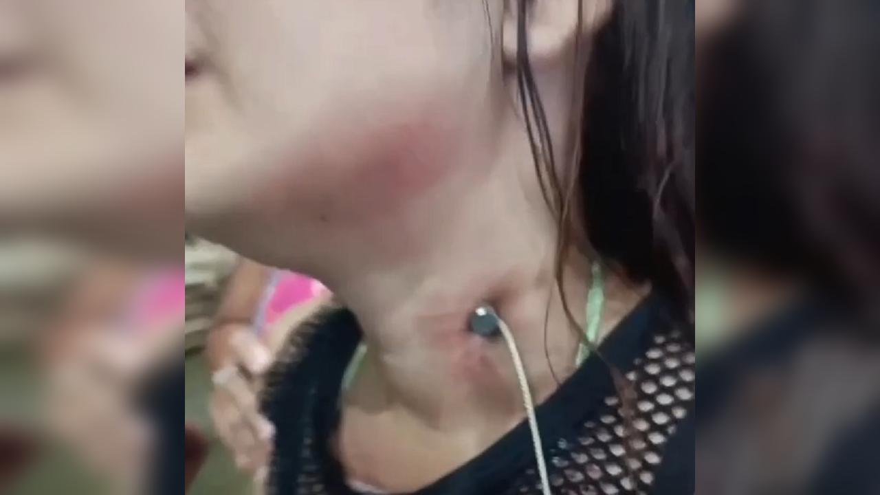 Namorado crava prego no pescoço de jovem e foge Namorado crava prego no pescoço de jovem e foge