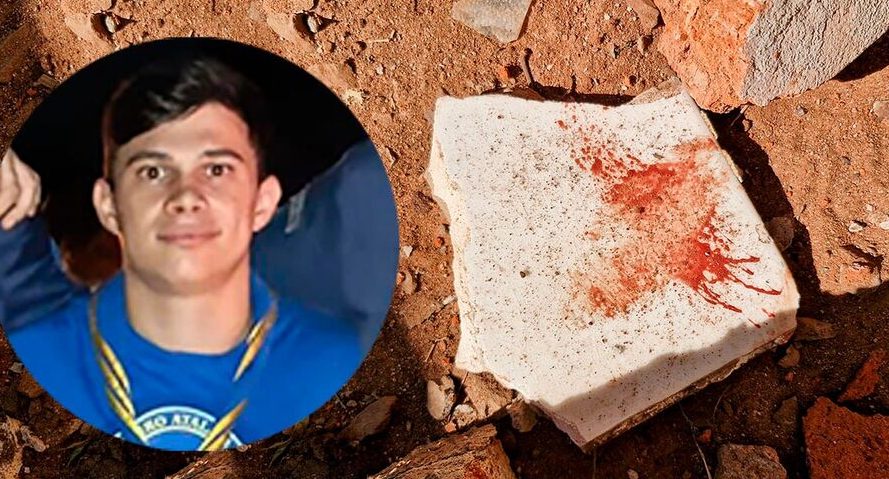 “Ele não lembra do ataque”, diz mãe de jovem dilacerado por Pitbulls