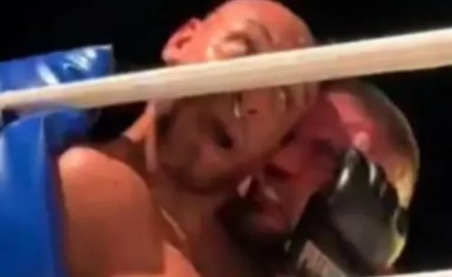 Lutador arranca orelha do adversário durante luta de MMA Imagem referente a Lutador arranca orelha do adversário durante luta de MMA