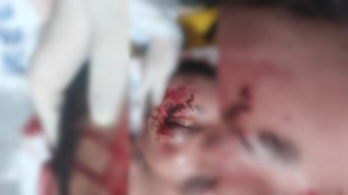 Imagem mostra grave lesão em jovem que foi encontrado espancado no meio da rua Imagem referente a Imagem mostra grave lesão em jovem que foi encontrado espancado no meio da rua