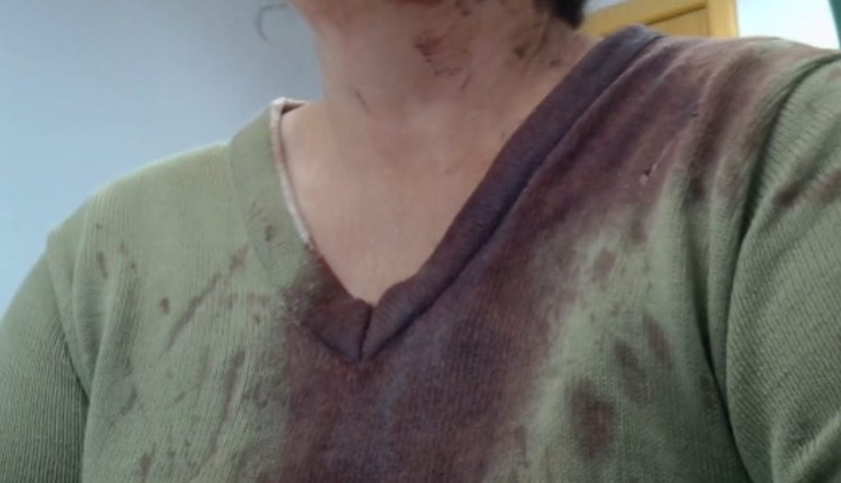 Briga de irmãs termina em sangue: mulher é presa após atacar parente com cabo de aço