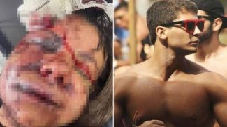 Desfigurada, vítima espancada por ex em elevador só conseguiu depor por escrito