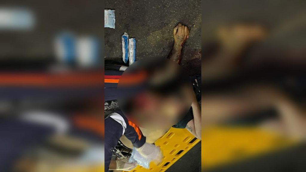 Motociclista sobrevive após ter braço arrancado em acidente com micro-ônibus Motociclista sobrevive após ter braço arrancado em acidente com micro-ônibus