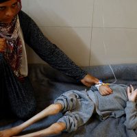 Imagem referente a FAO aponta que fome chegou a pior patamar em Gaza