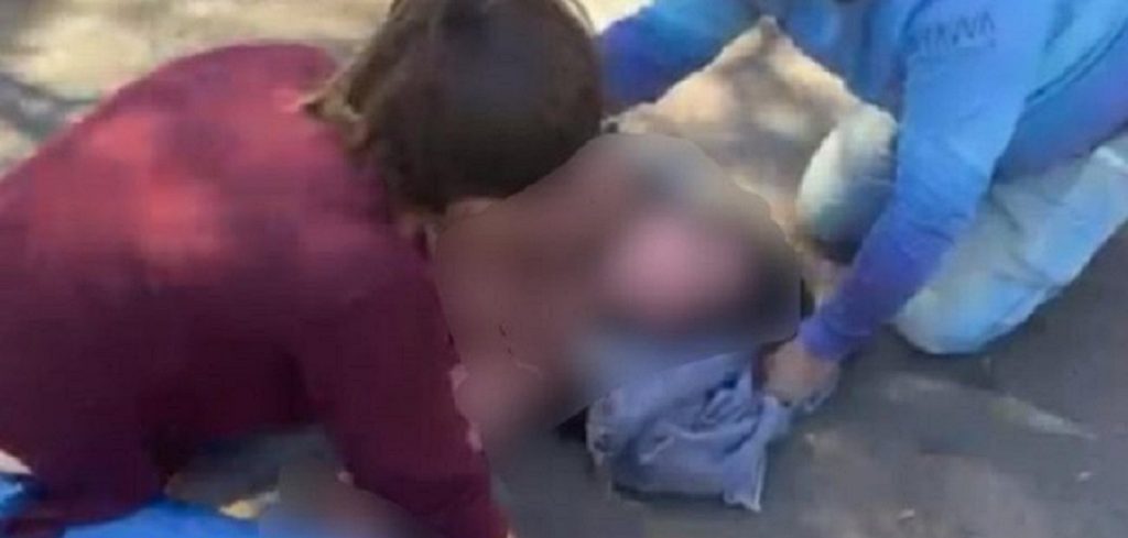 Jovem de 15 anos é entubada após acidente de patinete elétrico