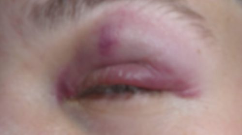 Esposa contrata mulher para dar surra na amante do marido em Goioerê Imagem referente a Esposa contrata mulher para dar surra na amante do marido em Goioerê