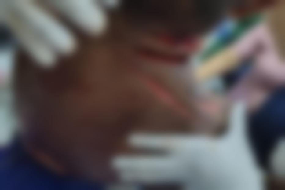 Ataque brutal: Aposentado quase é degolado em tentativa de assalto Ataque brutal: Aposentado quase é degolado em tentativa de assalto
