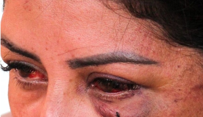 Policial aposentado é preso por bater na esposa