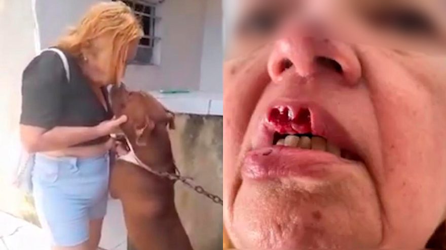 Mulher é mordida nos lábios ao tentar beijar Pitbull amarrado