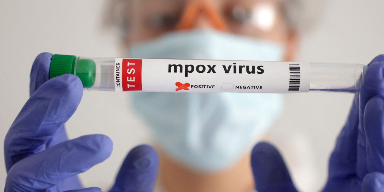 Mpox: África tem quase 50 mil casos confirmados Imagem referente a Mpox: África tem quase 50 mil casos confirmados