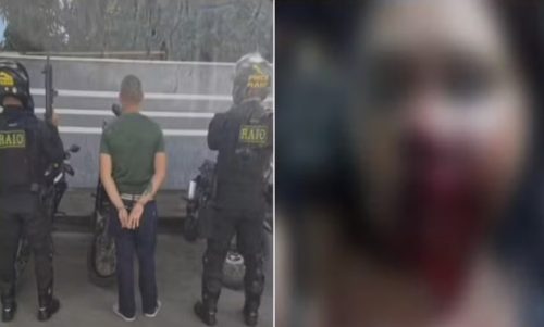 Homem é preso após desfigurar rosto de companheira enquanto dormia Imagem referente a Homem é preso após desfigurar rosto de companheira enquanto dormia