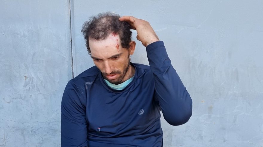 “Me deu uma facãozada na cabeça”, relata vítima de assalto que teve a bicicleta roubada em Cascavel