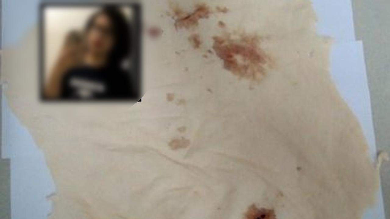 Universitária é investigada por matar animais