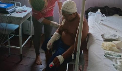 Imagens fortes: Homem sobrevive a feroz ataque de onça Imagem referente a Imagens fortes: Homem sobrevive a feroz ataque de onça