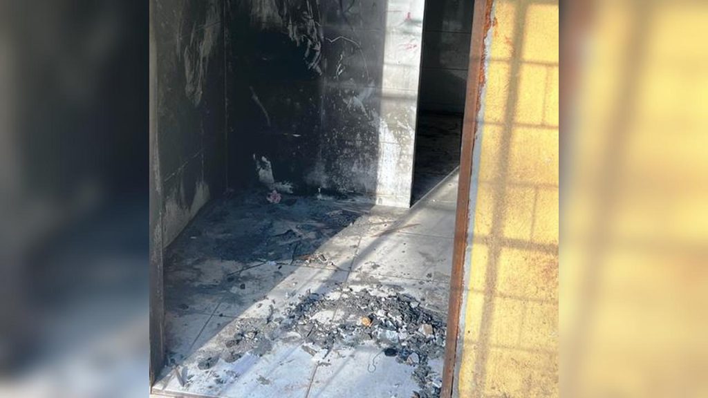Mulher tem duas pernas amputadas após ficar ferida em incêndio em Goioerê