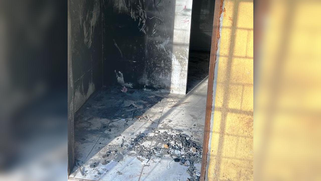 Mulher tem duas pernas amputadas após ficar ferida em incêndio em Goioerê