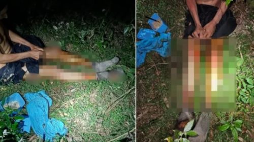 Homem é encontrado com 37% do corpo queimado e acusa outra pessoa de atear fogo Imagem referente a Homem é encontrado com 37% do corpo queimado e acusa outra pessoa de atear fogo