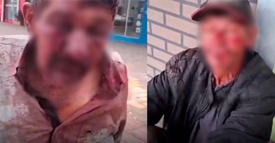 Covardia! Vídeo mostra idosos indefesos sendo espancados; Agressor foi preso