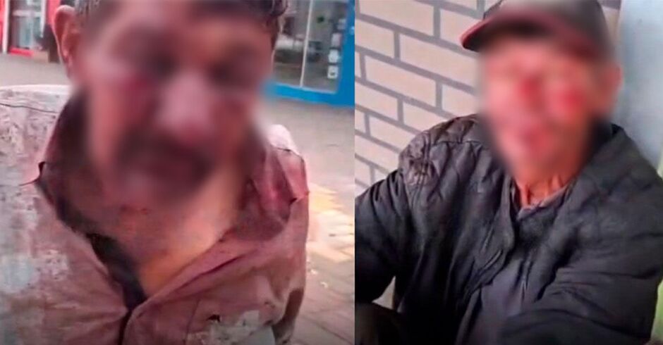 Covardia! Vídeo mostra idosos indefesos sendo espancados; Agressor foi preso