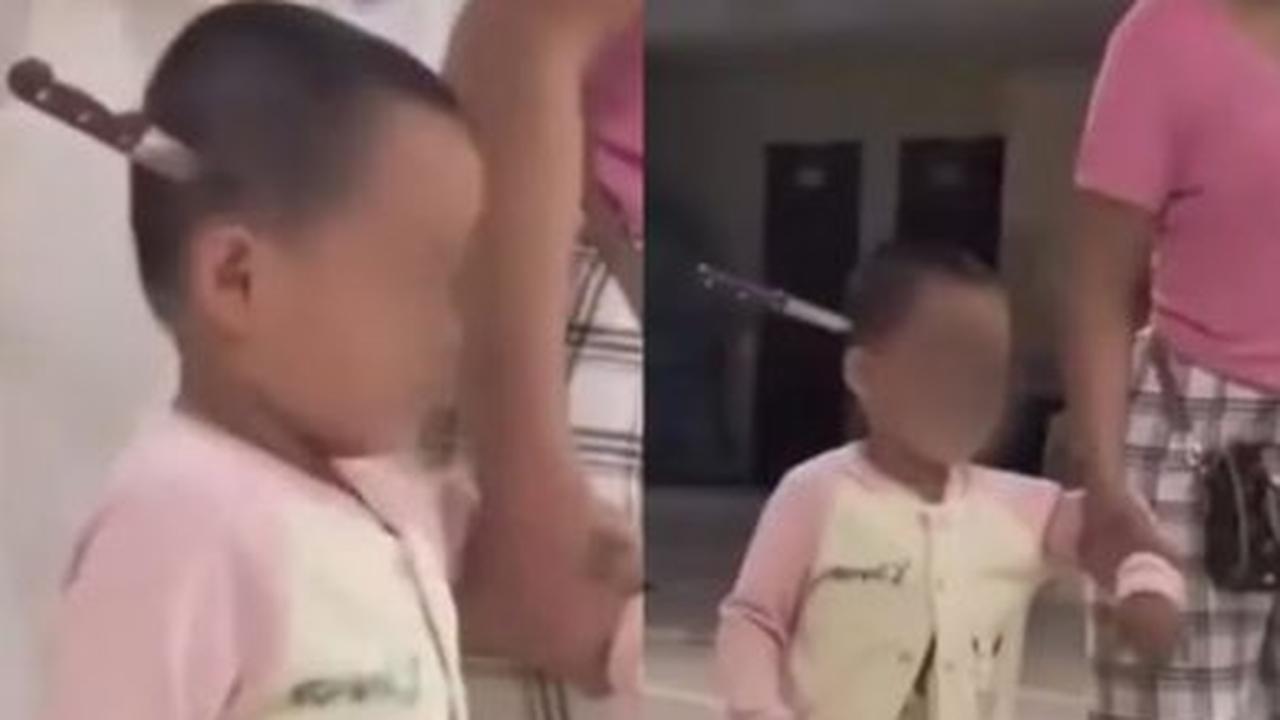 Menina de 3 anos é socorrida com faca cravada na cabeça