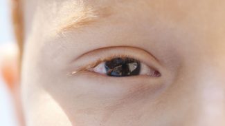 Erros de refração são principal causa de deficiência visual infantil