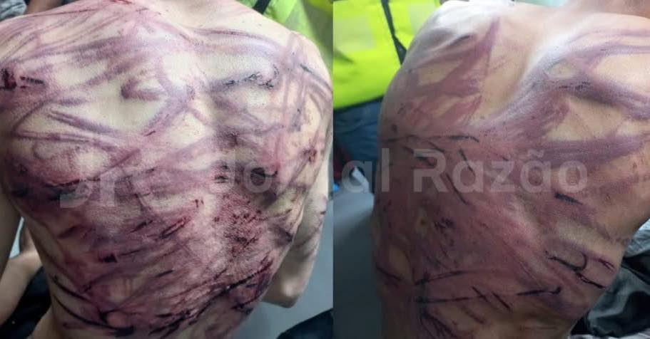 Dupla suspeita de furtos fica 'esfolada' após virar alvo de justiceiros