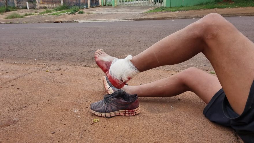 Homem é atacado por cachorro no bairro Santa Cruz