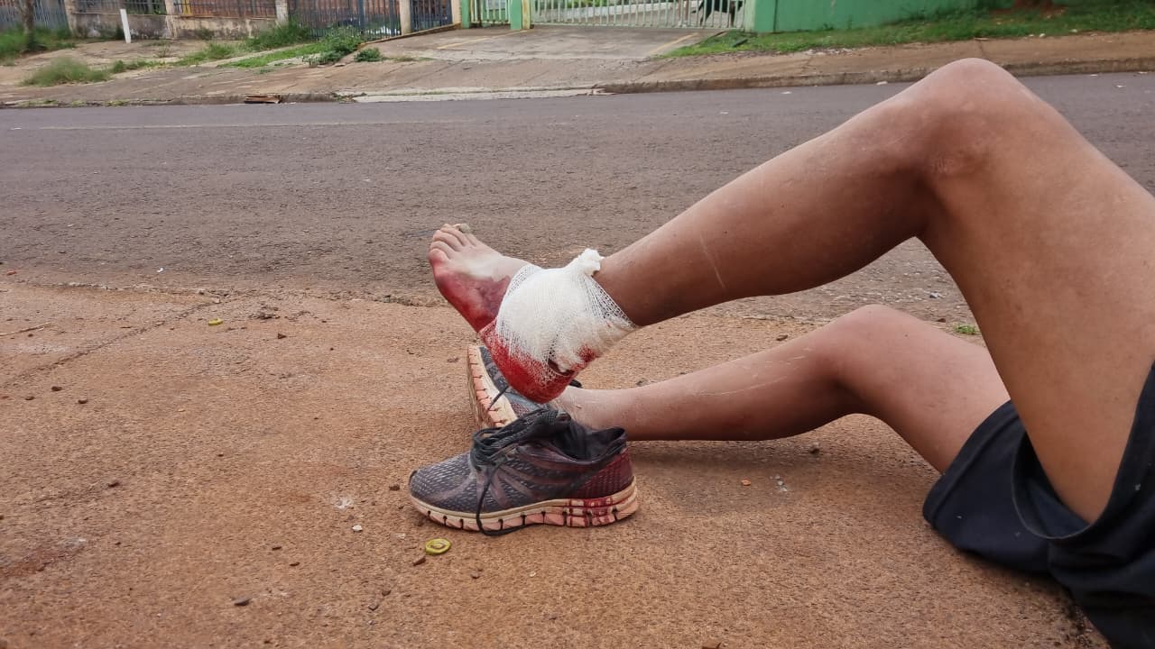 Homem é atacado por cachorro no bairro Santa Cruz